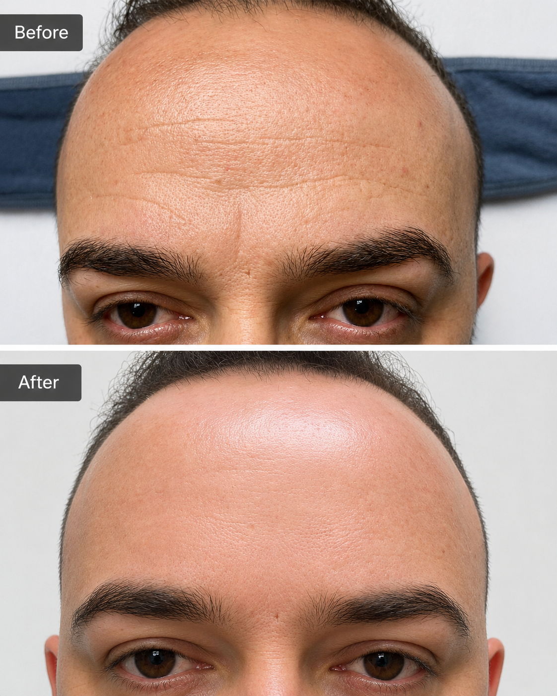 Treatment result at Tu Bella Beauty Salon Hemel Hempstead